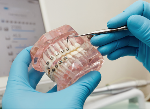 Plastic Model with Braces
