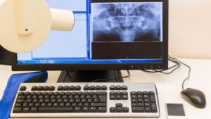 orthognathic surgery